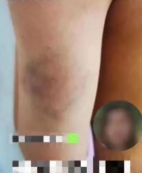 Nữ giáo viên bị đuổi việc vì đánh học sinh