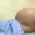 Người phụ nữ tưởng béo bụng, ngỡ ngàng phát hiện khối u nặng 10kg